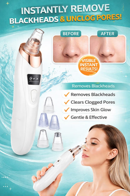 NoGrit Blackhead Vacuum & Pore Cleaner